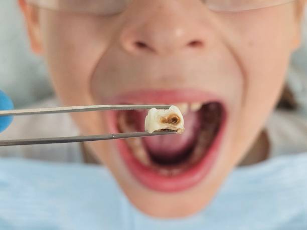 Best Mobile Emergency Dentist in Estero, FL